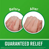 O'Keeffe's Working Hands Hand Cream (3.4 oz Jar), Repairing Skincare for Extremely Dry, Cracked Hands and Feet